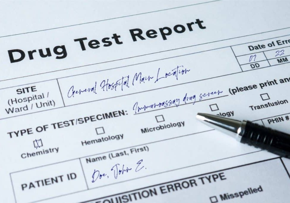 CBD Drug Test: Will Taking CBD Show Up?