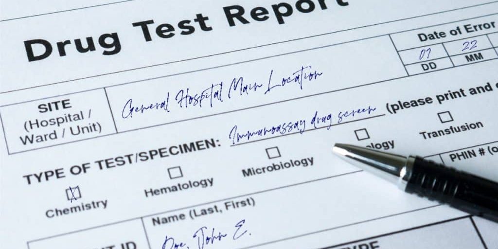 CBD Drug Test: Will Taking CBD Show Up?